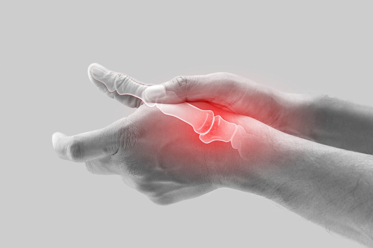 Grey'd hands with red over swollen wrist joint