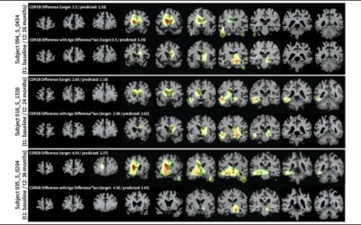 AI system can analyze serial medical images