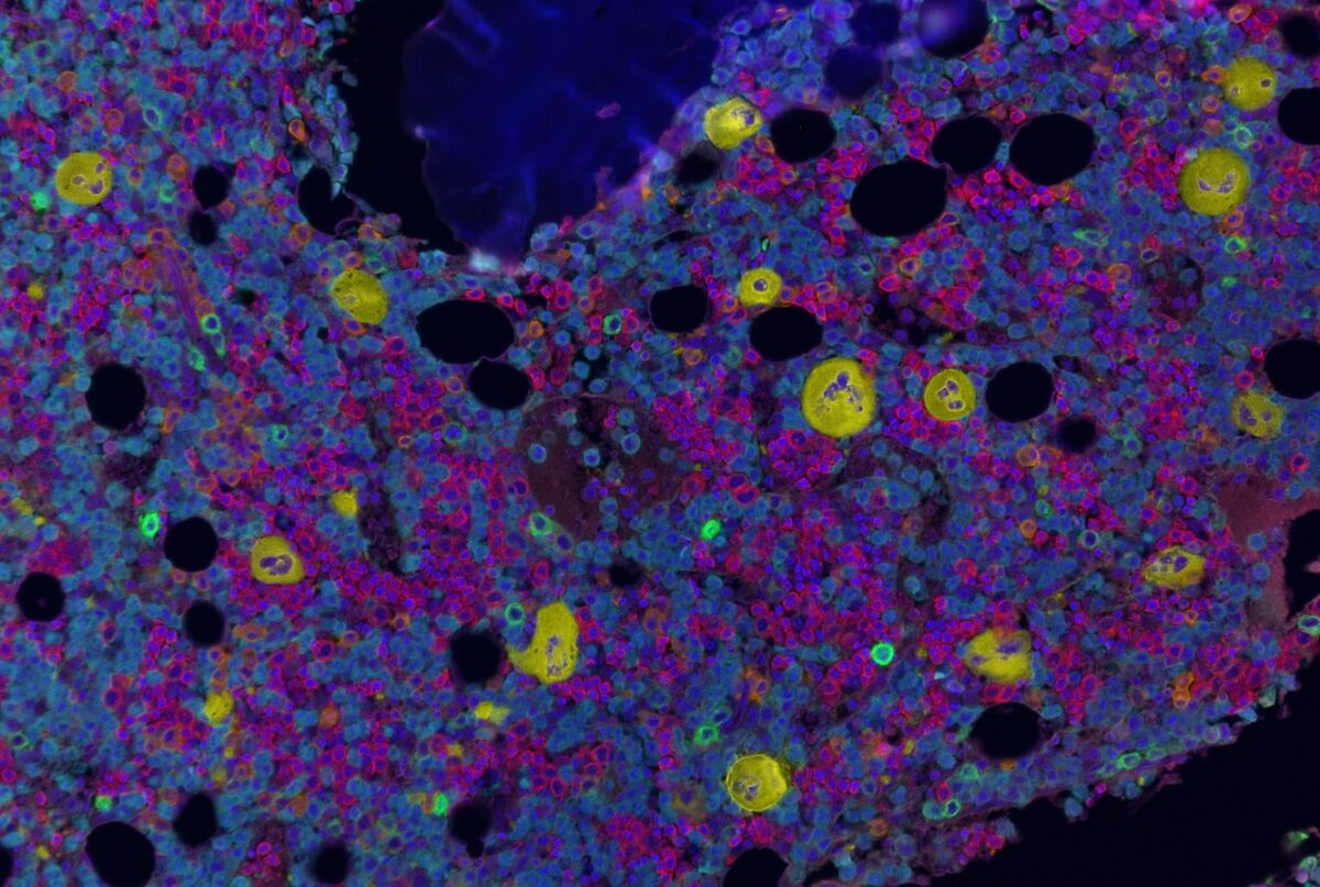 microscope image of bone marrow